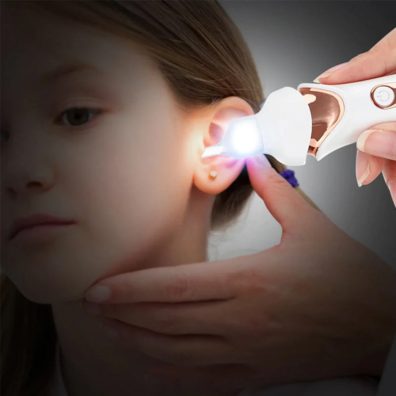 5 in 1 Electric Earwax Cleaner | Kalsten