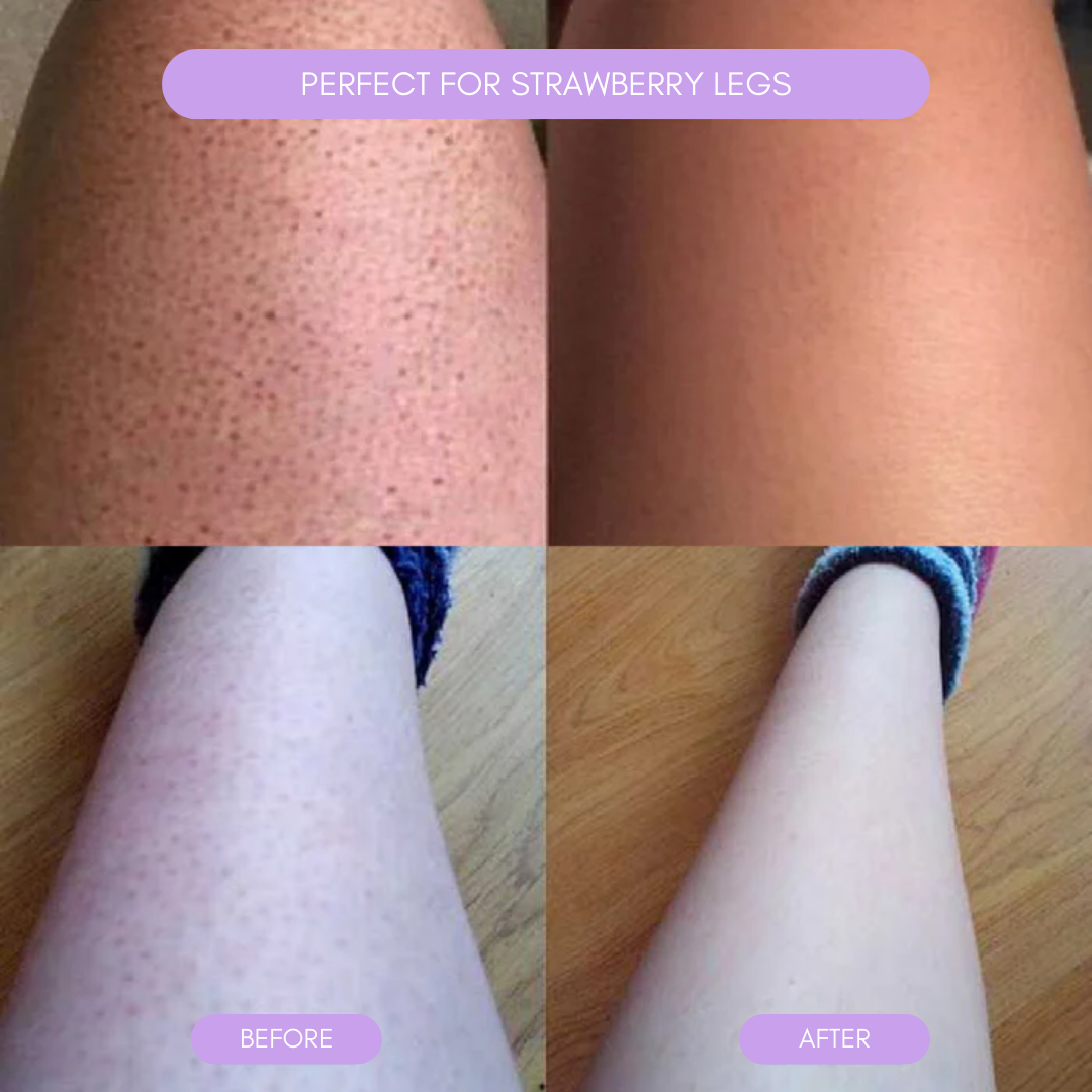 Hair Removal Device for Smooth Skin Noxord