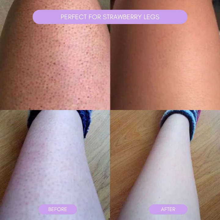 Hair Removal Device for Smooth Skin Noxord