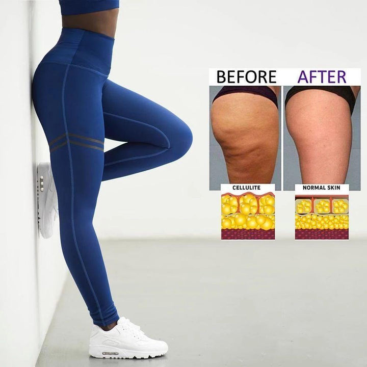 Anti-Cellulite Compression Leggings for Women