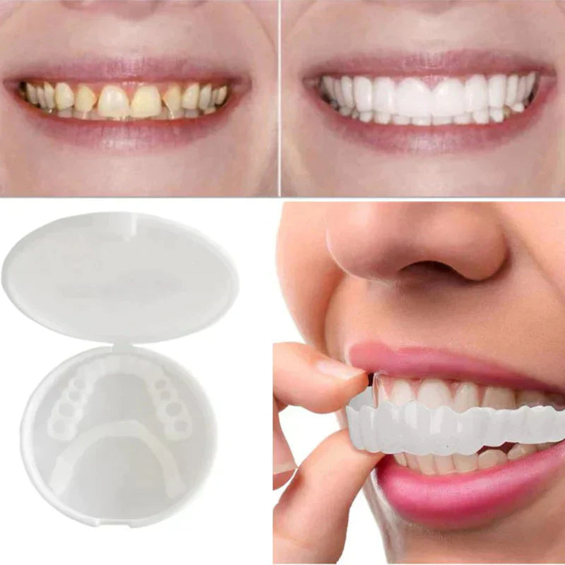 Kalsten | SnapFit Dental Restoration | Always a Flawless Smile