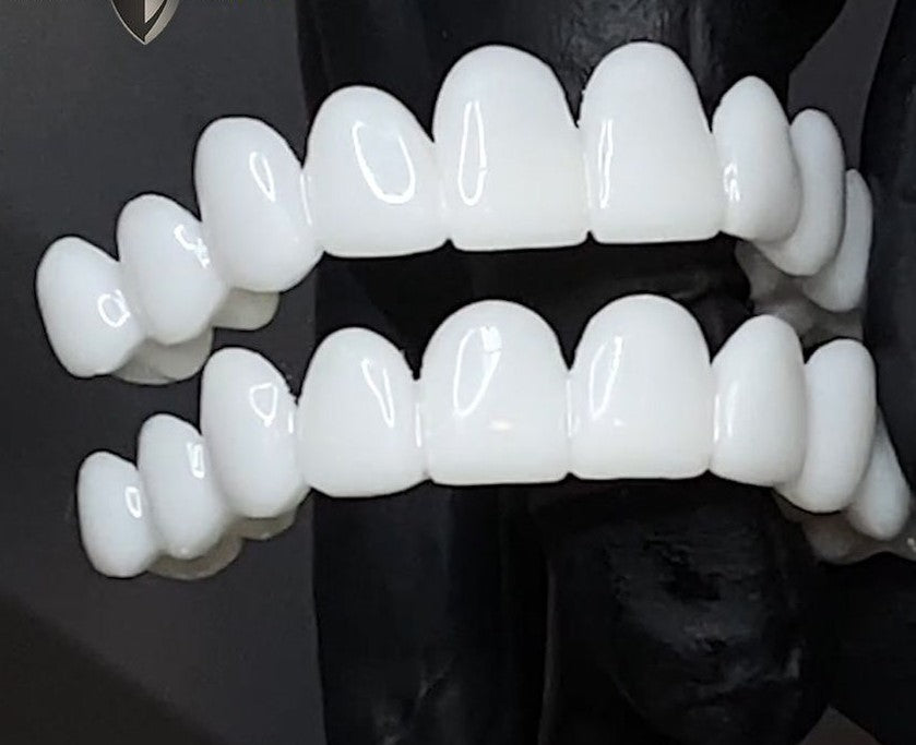 Kalsten | 100% Adjustable Whitening Fake Invisible Holeless Braces