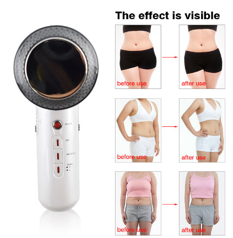 Kalsten | Ultrasound Massage Device