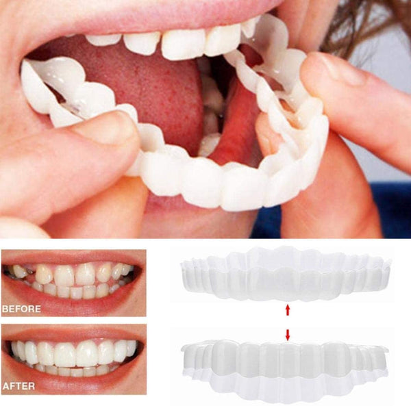 Instant Smile Veneers (Upper & Lower Set)