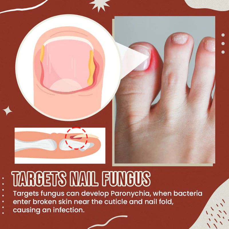 Kalsten | Nail Anti-Fungus Socks