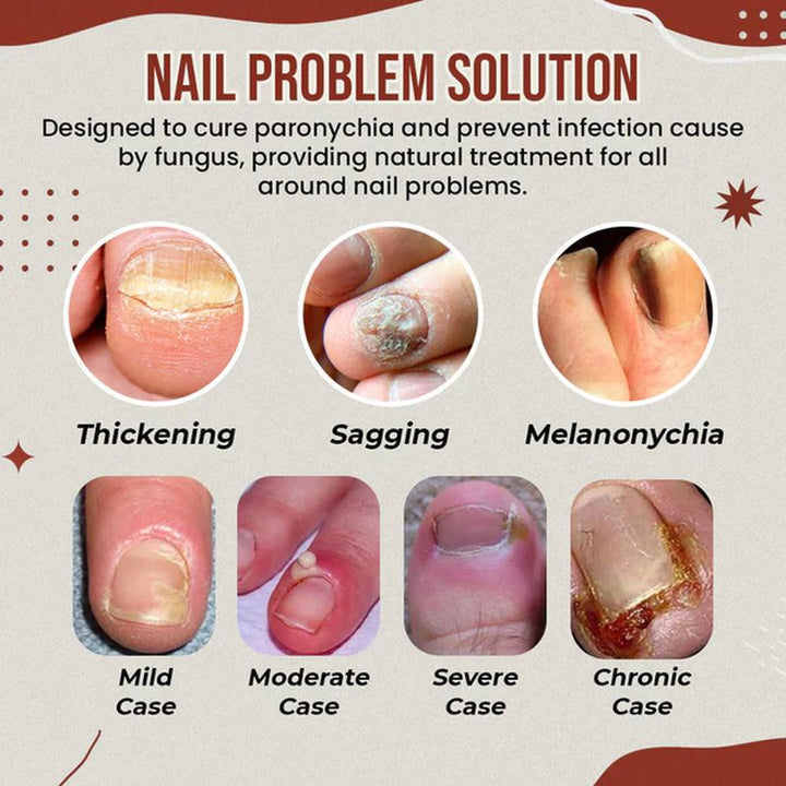 Kalsten | Nail Anti-Fungus Socks