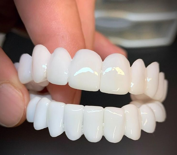 Smile Lens – Adjustable White Denture for Instant Smile Correction | Kalsten