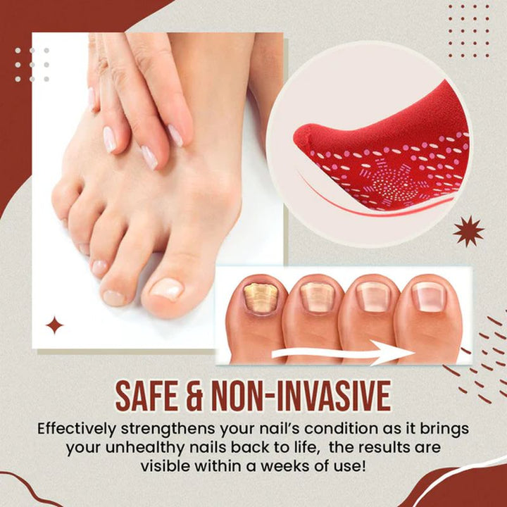 Kalsten | Nail Anti-Fungus Socks