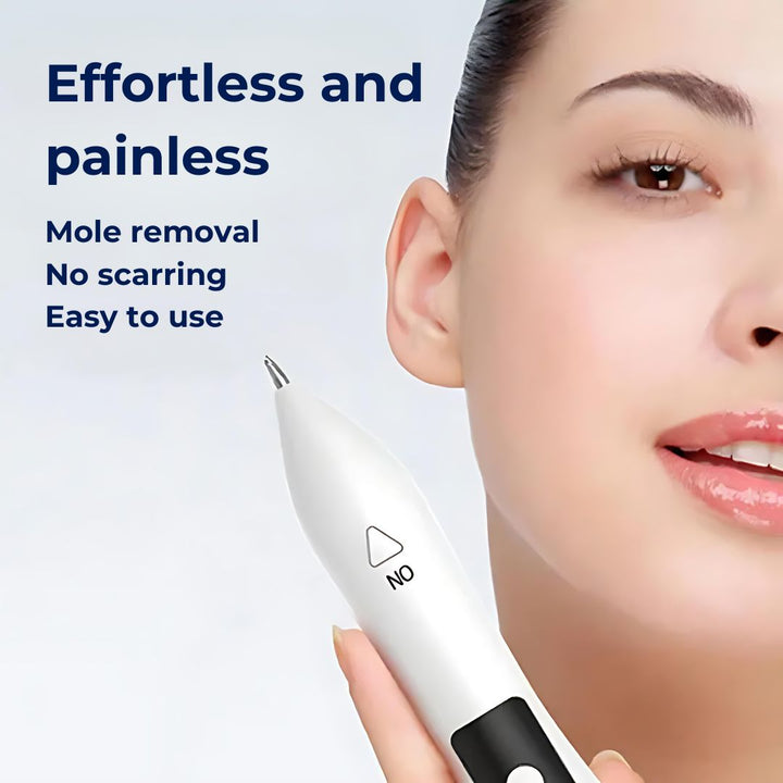 ClearSkinPro Laser Plasma Pen - Non-Invasive | for Freckle, Skin Tag, Spot, Mole and Tattoo Removal at Home Kalsten