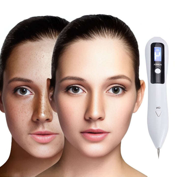 ClearSkinPro Laser Plasma Pen - Non-Invasive | for Freckle, Skin Tag, Spot, Mole and Tattoo Removal at Home Kalsten