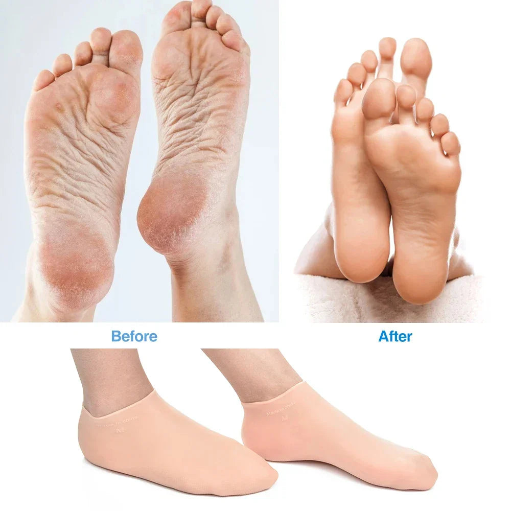 Kalsten | Silicone Wetsuit Beach Socks