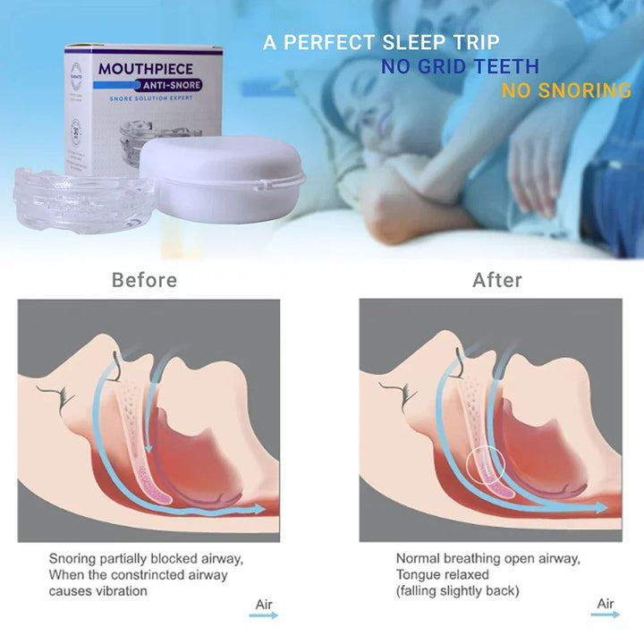 Kalsten | Anti-Snore Mouthpiece