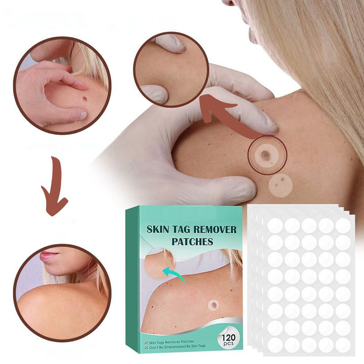 SkinClear - Patch for the removal of spots and warts Kalsten
