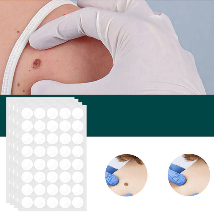 SkinClear - Patch for the removal of spots and warts Kalsten