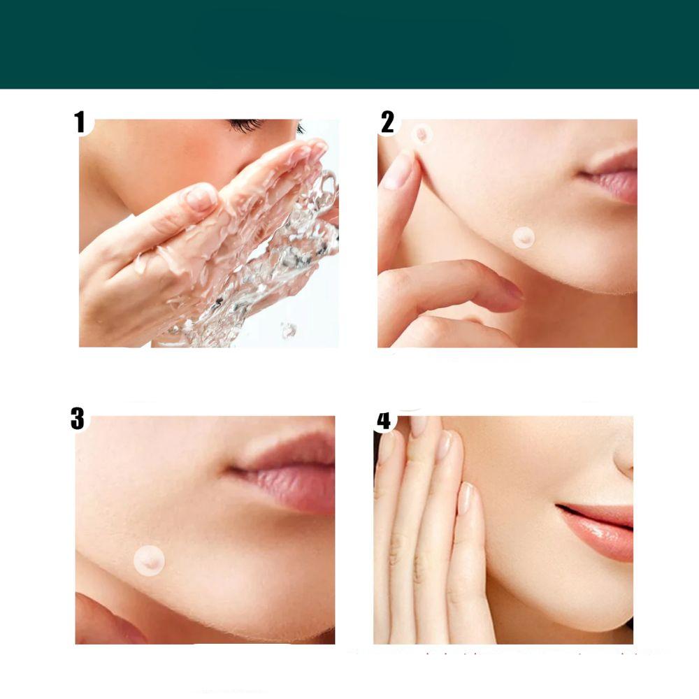 SkinClear - Patch for the removal of spots and warts Kalsten