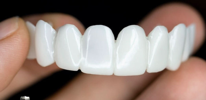 Kalsten | Customizable Dental Prosthesis with Dental Lenses