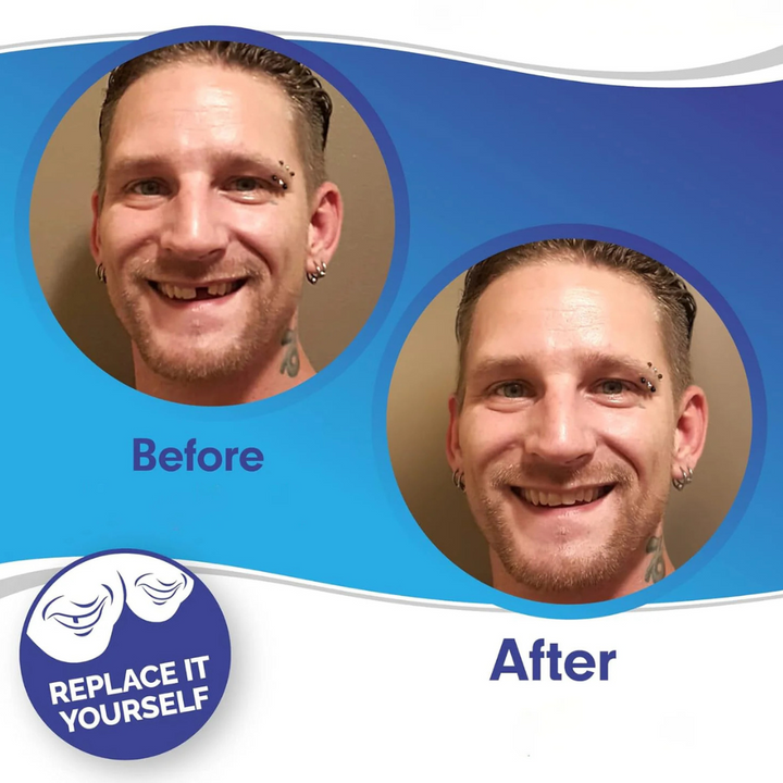 Kalsten | Removable Veneers Teeth Cover