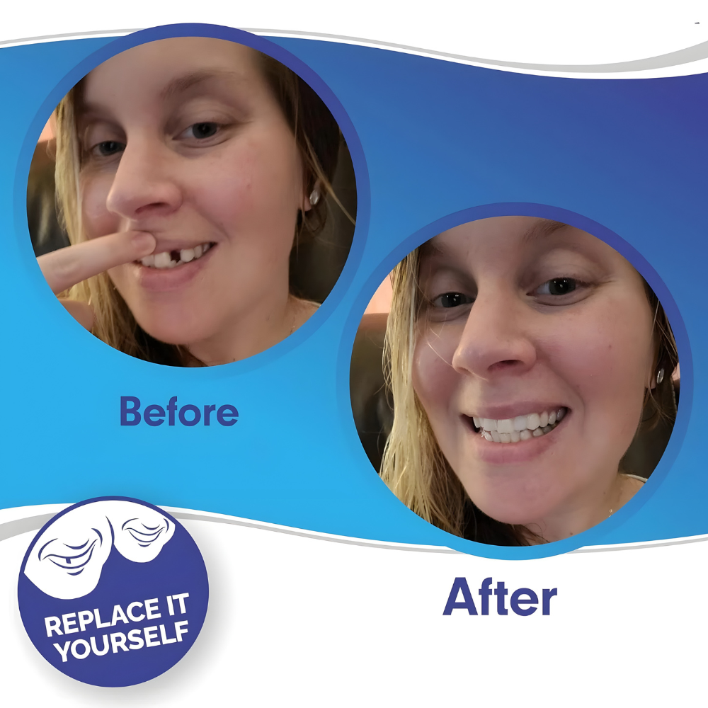 Removable Fillings Tooth Cover Kalsten