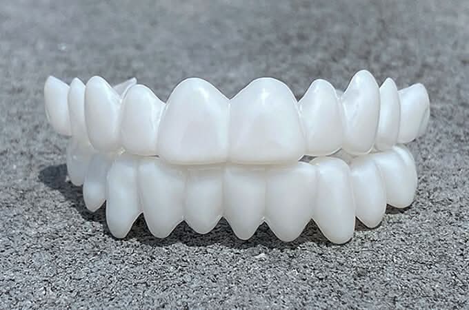 Kalsten | Dental prosthesis with white dental lenses