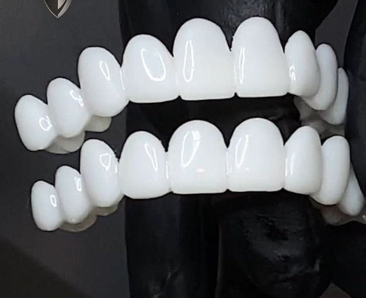 Kalsten | Dental prosthesis with white dental lenses