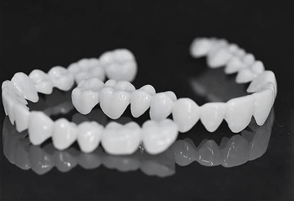 Kalsten | Dental prosthesis with white dental lenses