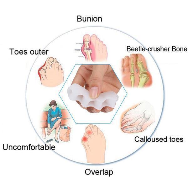 Kalsten | Orthopedic Toe Corrector - Toe Separator